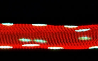 microscope image of red band with white spots