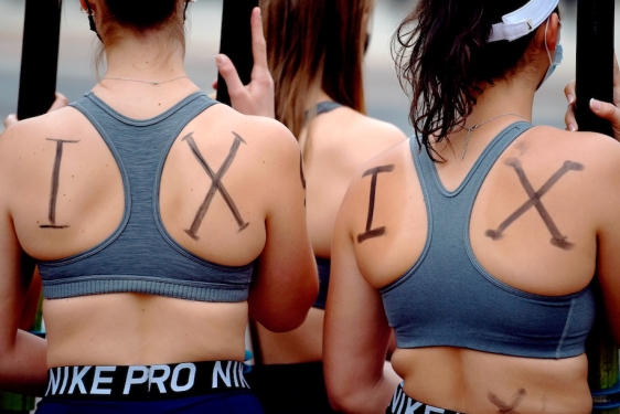 photo of women with I X written on their backs